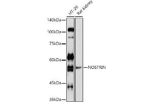Immunofluorescence analysis of U-2 OS cells using NOSTRIN Rabbit pAb (ABIN7268922) at dilution of 1:100 (40x lens). (NOSTRIN antibody  (AA 207-506))