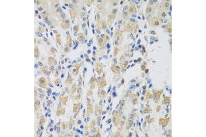 Immunohistochemistry of paraffin-embedded human stomach using VPS4A antibody (ABIN5974267) at dilution of 1/100 (40x lens).