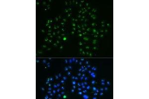 Immunofluorescence analysis of MCF7 cells using GNL3 Polyclonal Antibody (Nucleostemin antibody)