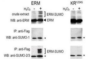 COS-7 cells were transfected for 24 hrs with a plasmid expressing FLAG-ERM (left panels) or FLAG-ERM KR12345 (right panels).