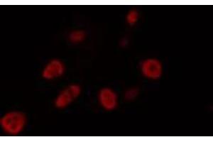 ABIN6274462 staining LOVO cells by IF/ICC. (FOXJ1 antibody  (Internal Region))