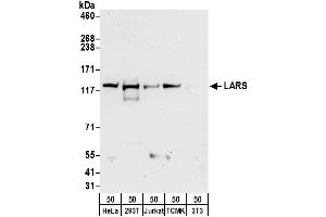Western Blotting (WB) image for anti-Leucyl-tRNA Synthetase (LARS) (AA 250-300) antibody (ABIN7454577)