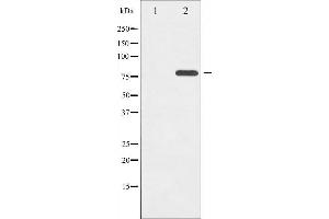 Western blot analysis of ETK phosphorylation expression in Serum treated HeLa whole cell lysates,The lane on the left is treated with the antigen-specific peptide. (BMX antibody  (pTyr566))
