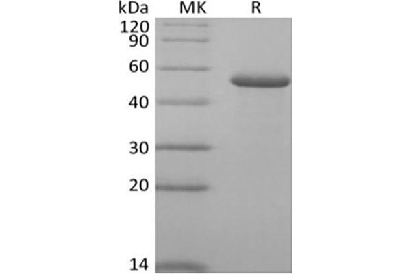 RCN2 Protein (His tag)