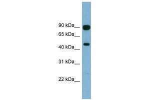 AGK antibody used at 1 ug/ml to detect target protein. (Acylglycerol Kinase antibody  (N-Term))