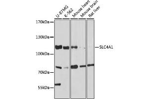 Western blot analysis of extracts of various cell lines, using SLC4 antibody (7391) at 1:1000 dilution.