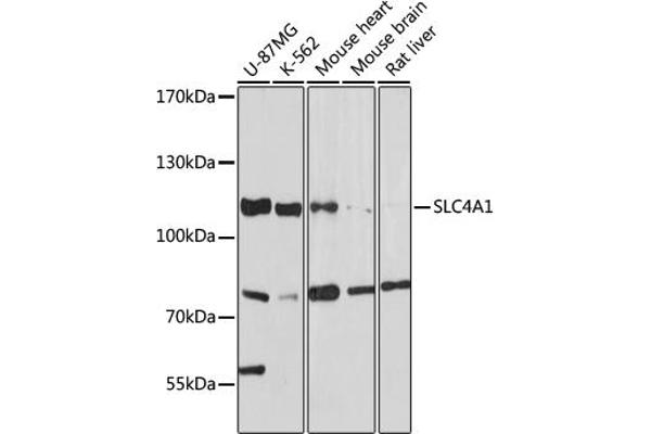 Band 3/AE1 anticorps  (AA 1-353)