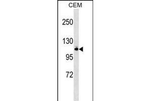 GRIK5 anticorps  (N-Term)