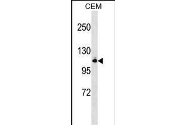 GRIK5 antibody  (N-Term)