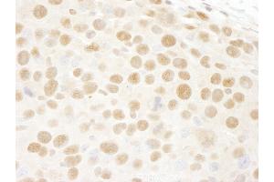 anti-Retinoblastoma Binding Protein 4 (RBBP4) (AA 1-50) antibody