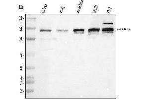 Western blot analysis of ABL2 using anti-ABL2 antibody (ABIN4886412). (ABL2 antibody  (AA 1065-1182))