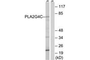 Western Blotting (WB) image for anti-Phospholipase A2, Group IVC (Cytosolic, Calcium-Independent) (PLA2G4C) (AA 301-350) antibody (ABIN2890254) (PLA2G4C antibody  (AA 301-350))
