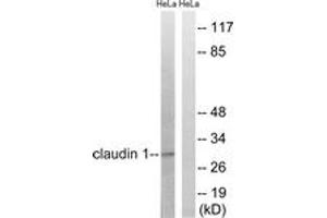 Western blot analysis of extracts from HeLa cells, treated with Hu 2nM 24h, using Claudin 1 (Ab-210) Antibody. (Claudin 1 antibody  (AA 162-211))
