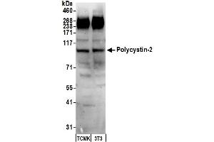 Western Blotting (WB) image for anti-Polycystic Kidney Disease 2 (Autosomal Dominant) (PKD2) (AA 918-968) antibody (ABIN7451972)