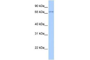 Transfected 293T; WB Suggested Anti-ZNF76 Antibody Titration: 0. (ZNF76 antibody  (Middle Region))