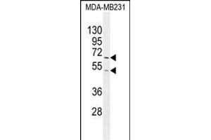FUT8 Antibody (Center) (ABIN2802043 and ABIN2844707) western blot analysis in MDA-M cell line lysates (35 μg/lane).