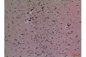 Immunohistochemistry (IHC) analysis of paraffin-embedded Mouse Brain, antibody was diluted at 1:100. (Cullin 4B antibody  (Internal Region))