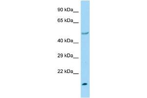 Host:  Rabbit  Target Name:  Ube2h  Sample Type:  Rat Heart lysates  Antibody Dilution:  1. (UBE2H antibody  (C-Term))