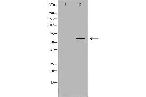 Western blot analysis of Hela whole cell lysates, using PPP3CA  Antibody. (PPP3CA antibody  (N-Term))