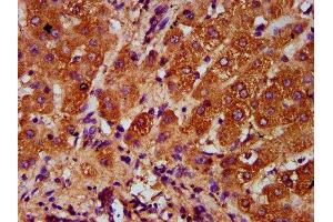 IHC image of ABIN7143840 diluted at 1:400 and staining in paraffin-embedded human liver tissue performed on a Leica BondTM system. (AASS antibody  (AA 224-364))