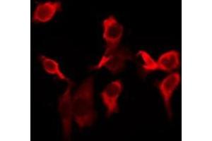 ABIN6277050 staining Hela by IF/ICC. (CD247 antibody  (C-Term))