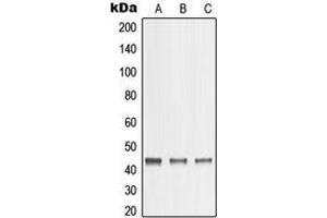 Western blot analysis of MMP23 expression in A431 (A), A375 (B), HeLa (C) whole cell lysates.