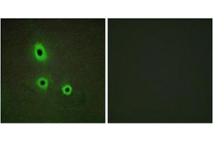 Immunofluorescence analysis of A549 cells, using EFNA5 antibody. (Ephrin A5 antibody  (Internal Region))