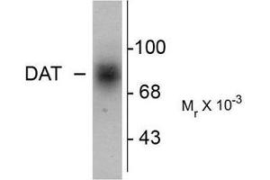Image no. 1 for anti-Solute Carrier Family 6 (Neurotransmitter Transporter, Dopamine), Member 3 (SLC6A3) (C-Term) antibody (ABIN372613) (SLC6A3 antibody  (C-Term))