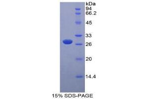 SDS-PAGE (SDS) image for Myosin Light Chain Kinase (MYLK) (AA 1684-1884) protein (His tag,GST tag) (ABIN1879232)