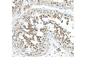 IHC analysis of SNUPN using anti-SNUPN antibody (ABIN7599310). (Snurportin 1 antibody  (AA 1-360))
