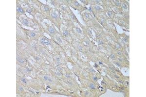 Immunohistochemistry of paraffin-embedded Human liver using RPH3AL Polyclonal Antibody at dilution of 1:100 (40x lens). (RPH3AL antibody)