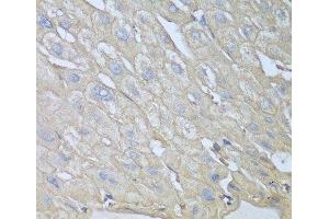 Immunohistochemistry of paraffin-embedded Human liver using RPH3AL Polyclonal Antibody at dilution of 1:100 (40x lens).