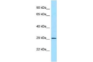 Western Blotting (WB) image for anti-Phosphomannomutase 2 (PMM2) (N-Term) antibody (ABIN2789674)