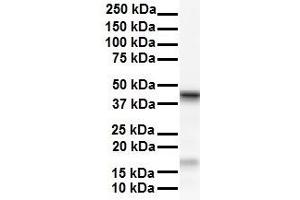 WB Suggested Anti-SMYD5 antibody Titration: 1 ug/mL Sample Type: Human HepG2 (SMYD5 antibody  (C-Term))