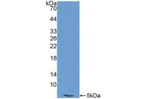 Detection of Recombinant EDN1, Human using Polyclonal Antibody to Endothelin 1 (EDN1) (Endothelin 1 antibody  (AA 53-90))