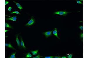 Immunofluorescence (IF) image for anti-Protein Disulfide Isomerase Family A, Member 3 (PDIA3) (AA 1-505) antibody (ABIN950005)