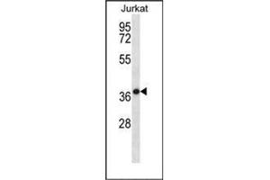 Western blot analysis of HSPBP1 Antibody (N-term) in Jurkat cell line lysates (35ug/lane). (HSPBP1 antibody  (N-Term))