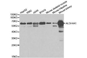 Western blot analysis of extracts of various cell lines, using ALDH4A1 antibody.