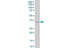 CAPZA2 polyclonal antibody (A01), Lot # 060525JCS1. (CAPZA2 antibody  (AA 111-169))