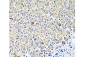 Immunohistochemistry of paraffin-embedded Mouse stomach using GLS Polyclonal Antibody at dilution of 1:100 (40x lens). (Glutaminase antibody)