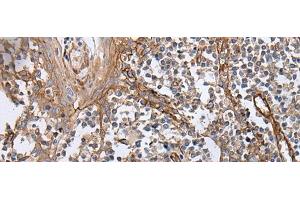 Immunohistochemistry of paraffin-embedded Human tonsil tissue using BLVRB Polyclonal Antibody at dilution of 1:65(x200) (BLVRB antibody)