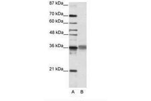 Image no. 2 for anti-T-Cell Leukemia Homeobox 2 (TLX2) (C-Term) antibody (ABIN202158) (TLX2 antibody  (C-Term))