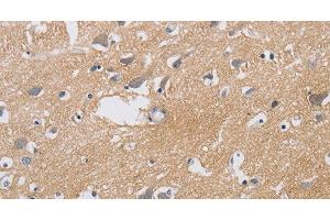 Immunohistochemistry of paraffin-embedded Human brain using KCNMB3 Polyclonal Antibody at dilution of 1:40 (KCNMB3 antibody)