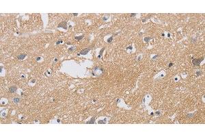 Immunohistochemistry of paraffin-embedded Human brain using KCNMB3 Polyclonal Antibody at dilution of 1:40