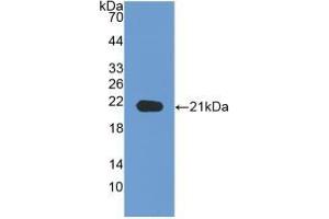 WB of Protein Standard: different control antibodies against Highly purified E. (Neuropilin 1 ELISA Kit)