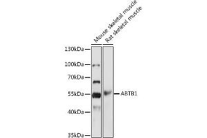 Western blot analysis of extracts of various cell lines, using  antibody  at 1:1000 dilution. (ABTB1 antibody)