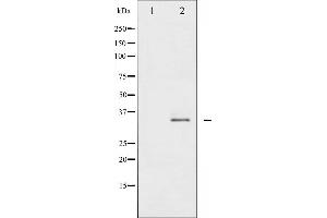 Western blot analysis of Syntaxin 1A phosphorylation expression in Mouse brain tissue lysates,The lane on the left is treated with the antigen-specific peptide. (STX1A antibody  (pSer14))
