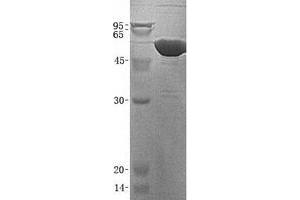 Validation with Western Blot (CES1 Protein (Transcript Variant 2) (His tag))
