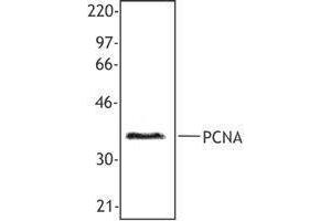 Western Blotting (WB) image for anti-Proliferating Cell Nuclear Antigen (PCNA) antibody (ABIN2665321) (PCNA antibody)