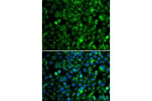 Immunofluorescence analysis of MCF7 cell using TMLHE antibody.